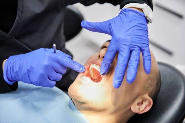 Best Broken Tooth Emergency  in Breckenridge, MN